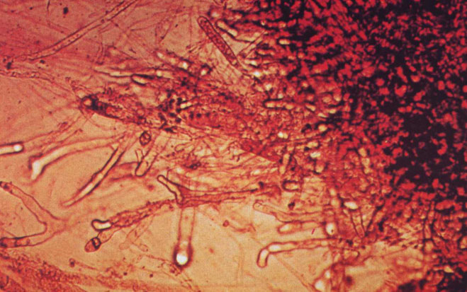 工廠化循環水養殖能否預防水霉病的發生?